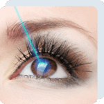 lasik