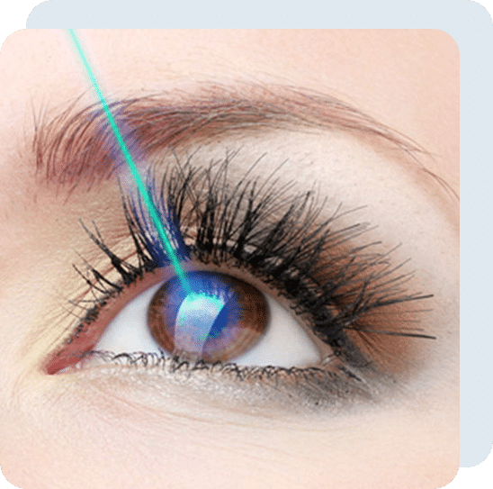 lasik